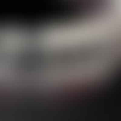 All You Need to Know about Spacers for Braces: Their Role and Importance
