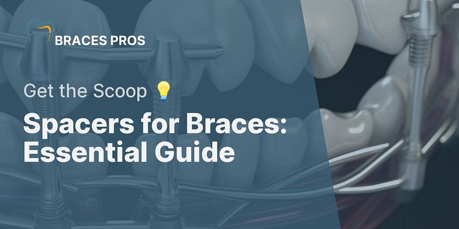 Spacers for Braces: Essential Guide - Get the Scoop 💡