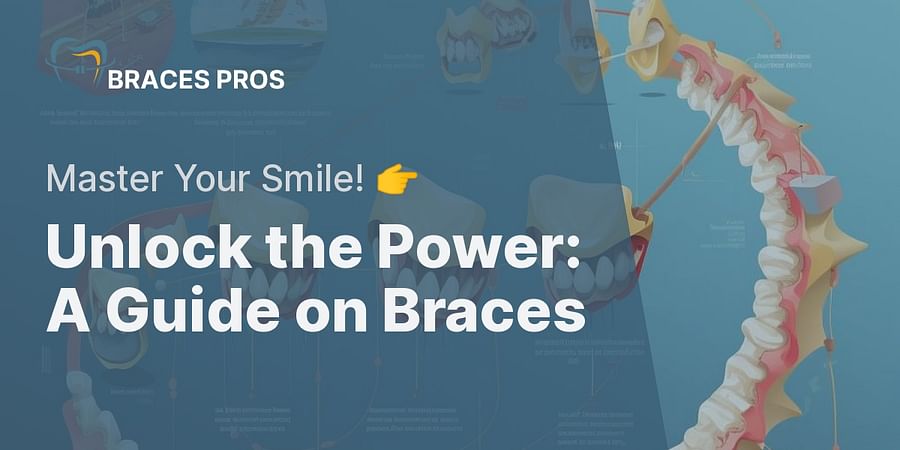Unlock the Power: A Guide on Braces - Master Your Smile! π
