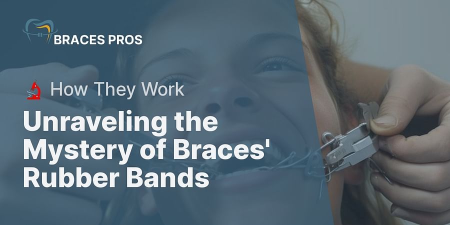 Unraveling the Mystery of Braces' Rubber Bands - 🔬 How They Work